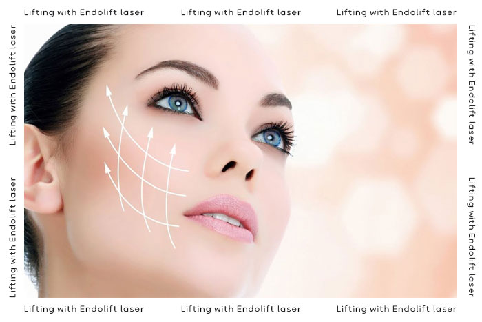 اندولیفت صورت