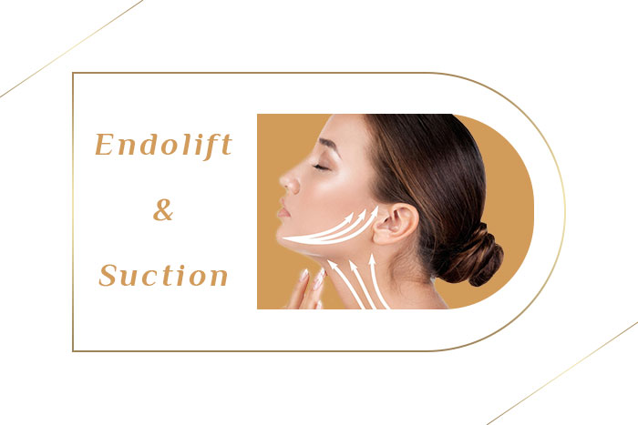 اندولیفت و ساکشن غبغب 