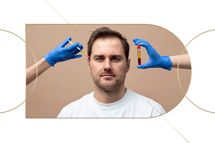 پی ار پی مو وصورت